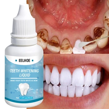 EELHOE 30 мл Эссенция для отбеливания зубов Гигиена полости рта Очищающая Сыворотка для отбеливания зубов Удаляет неприятный запах изо рта Налет Инструменты для отбеливания зубов
